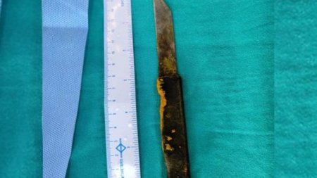Kişi 20 santimetrlik bıçağı uddu və sağ qaldı - FOTO